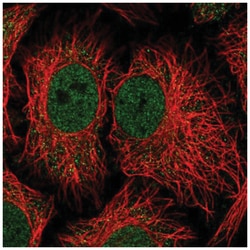 NADK Antibody, Novus Biologicals:Antibodies:Primary Antibodies