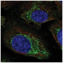 NAGS Antibody, Novus Biologicals 100&mu;L; Unlabeled:Antibodies, Polyclonal