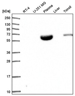 NARF Antibody, Novus Biologicals 100&mu;L; Unlabeled:Antibodies, Polyclonal