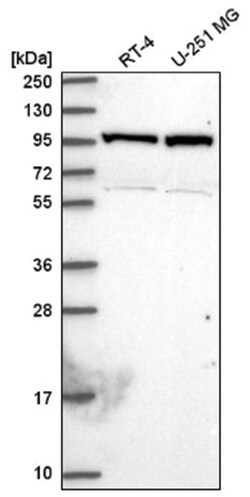 NARG1 Antibody, Novus Biologicals 100&mu;L; Unlabeled:Antibodies, Polyclonal