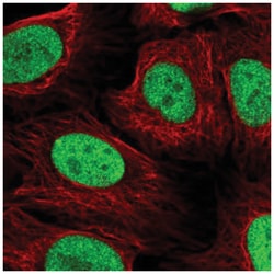 NAT9 Antibody, Novus Biologicals 100&mu;L; Unlabeled:Antibodies, Polyclonal