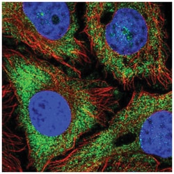 Natriuretic Peptide Receptor C Antibody, Novus Biologicals 25 &mu;L:Antibodies,