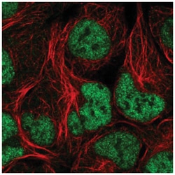 NCAPD3 Antibody, Novus Biologicals 25 &mu;L:Antibodies, Polyclonal