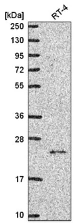 NCKIPSD Antibody, Novus Biologicals 100&mu;L; Unlabeled:Antibodies, Polyclonal