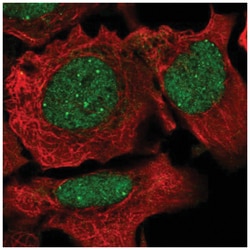 NCOA2 Antibody, Novus Biologicals 25 &mu;L:Antibodies, Polyclonal