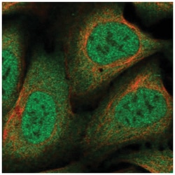 NCOR1 Antibody, Novus Biologicals:Antibodies:Primary Antibodies