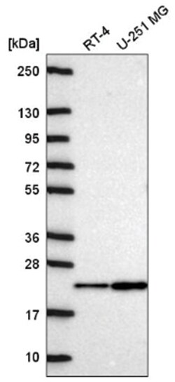 NDUFA11 Antibody, Novus Biologicals 100&mu;L; Unlabeled:Antibodies, Polyclonal