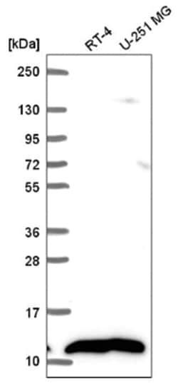 NDUFB1 Antibody, Novus Biologicals 25 &mu;L, Unlabeled:Antibodies, Polyclonal