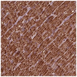 NDUFB10 Antibody, Novus Biologicals 25 &mu;L | Buy Online | Novus Biologicals | Fisher Scientific