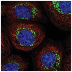 NDUFB6 Antibody, Novus Biologicals 25 &mu;L, Unlabeled:Antibodies, Polyclonal