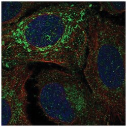 NDUFV2 Antibody, Novus Biologicals 25 &mu;L; Unlabeled:Antibodies, Polyclonal