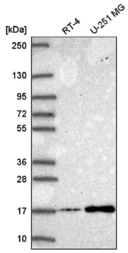 NEK6 Antibody, Novus Biologicals 100&mu;L; Unlabeled:Antibodies, Polyclonal