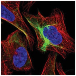Nestin Antibody, Novus Biologicals 25 &mu;L; Unlabeled:Antikörper