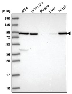 Neuregulin-2 Antibody, Novus Biologicals 100 &mu;L | Buy Online | Novus Biologicals | Fisher Scientific