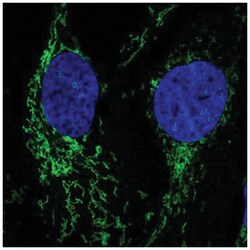 Neuroligin 2/NLGN2 Antibody, Novus Biologicals:Antibodies:Primary Antibodies