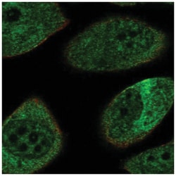 NF-L Antibody, Novus Biologicals 100&mu;L; Unlabeled:Antibodies, Polyclonal