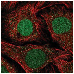 NFATC2IP Antibody, Novus Biologicals 100&mu;L; Unlabeled:Antibodies, Polyclonal