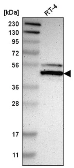 NFIX Antibody, Novus Biologicals:Antibodies:Primary Antibodies