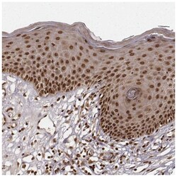NFX1 Antibody, Novus Biologicals 25 &mu;L, Unlabeled:Antibodies, Polyclonal