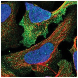 NG2/MCSP Antibody, Novus Biologicals 25 &mu;L, Unlabeled:Antibodies, Polyclonal