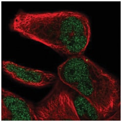 NHLRC2 Antibody, Novus Biologicals 25 &mu;L:Antibodies, Polyclonal