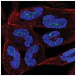NKIRAS2 Antibody, Novus Biologicals 25 &mu;L:Antibodies, Polyclonal