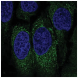 NKp46/NCR1 Antibody, Novus Biologicals 100&mu;L; Unlabeled:Antibodies,