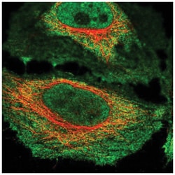 NKTR Antibody, Novus Biologicals 25 &mu;L, Unlabeled:Antibodies, Polyclonal