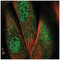 NLRP1/NALP1 Antibody, Novus Biologicals:Antibodies:Primary Antibodies