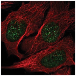 NME3 Antibody, Novus Biologicals 25 &mu;L, Unlabeled:Antibodies, Polyclonal