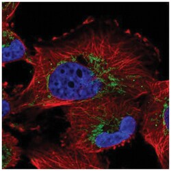 NME7 Antibody, Novus Biologicals 100&mu;L; Unlabeled:Antibodies, Polyclonal
