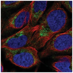 NMNAT3 Antibody, Novus Biologicals 25 &mu;L:Antibodies, Polyclonal