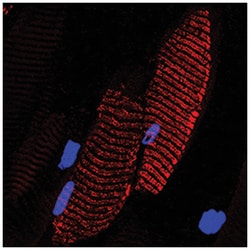 NOD1 Sheep anti-Human, Polyclonal, R D Systems 25&mu;g; Unlabeled:Antibodies,