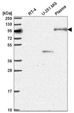 NOM1 Antibody, Novus Biologicals:Antibodies:Primary Antibodies