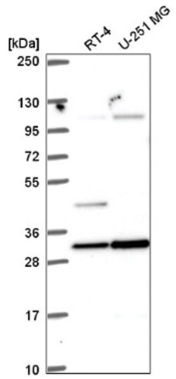 NORE1 Antibody, Novus Biologicals:Antibodies:Primary Antibodies