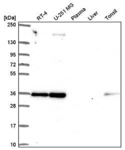 NOSIP Antibody, Novus Biologicals 25 &mu;L:Antibodies, Polyclonal