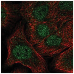 Notch-1 Antibody, Novus Biologicals:Antibodies:Primary Antibodies