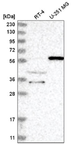 NRBP2 Antibody, Novus Biologicals:Antibodies:Primary Antibodies