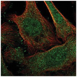NRIP Antibody, Novus Biologicals 100&mu;L; Unlabeled:Antibodies, Polyclonal