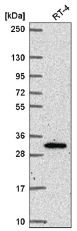 NRIP3 Antibody, Novus Biologicals 25 &mu;L, Unlabeled:Antibodies, Polyclonal