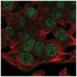 NSMCE4A Antibody, Novus Biologicals:Antibodies:Primary Antibodies