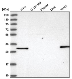 NSMCE4A Antibody, Novus Biologicals 25 &mu;L:Antibodies, Polyclonal