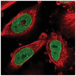 NSUN3 Antibody, Novus Biologicals:Antibodies:Primary Antibodies