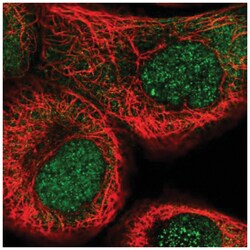 NSUN5 Antibody, Novus Biologicals 25 &mu;L, Unlabeled:Antibodies, Polyclonal
