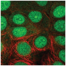 NUB1/NYREN18 Antibody, Novus Biologicals 25 &mu;L, Unlabeled:Antibodies,