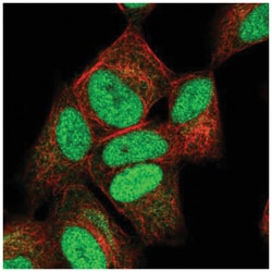 NUCKS1 Antibody, Novus Biologicals 100&mu;L; Unlabeled:Antibodies, Polyclonal