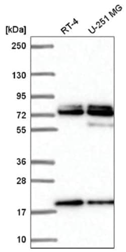 Nucleoporin NUP85 Antibody, Novus Biologicals:Antibodies:Primary Antibodies
