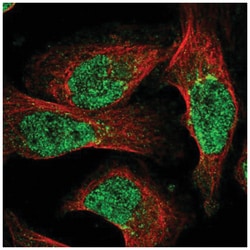 NUDT18 Antibody, Novus Biologicals 25 &mu;L; Unconjugated:Antibodies, Polyclonal
