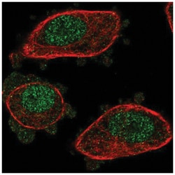NUDT2 Antibody, Novus Biologicals:Antibodies:Primary Antibodies