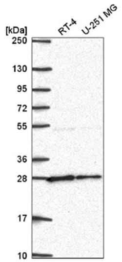 NUDT21 Antibody, Novus Biologicals 100&mu;L; Unlabeled:Antibodies, Polyclonal
